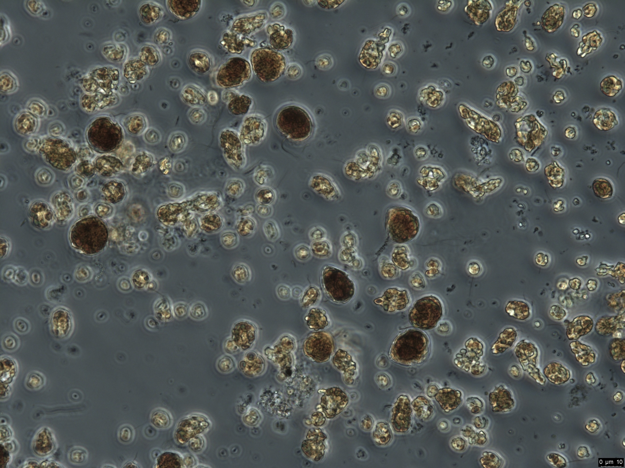 NIVA varslet om oppblomstringen allerede i begynnelsen av mars. Da ble det målt meget høye verdier av klorofyll-a, som er et mål for algebiomasse, ved iskanten i Bunnefjorden.